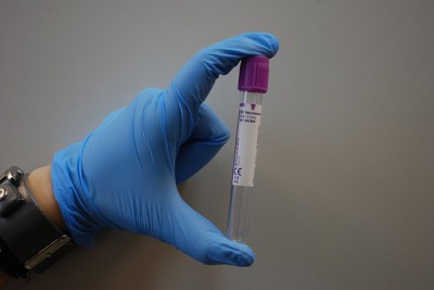 Δήλωση του υπουργού Υγείας, Ανδρέα Ξανθού αναφορικά με ανακοίνωση της ΠΑΣΙΔΙΚ
