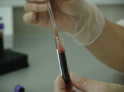 Το έργο και η δράση της νέας διοίκησης του ΕΑΝΠ Μεταξά